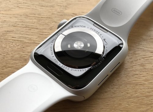 The Apple Watch has numerous sensors to collect data